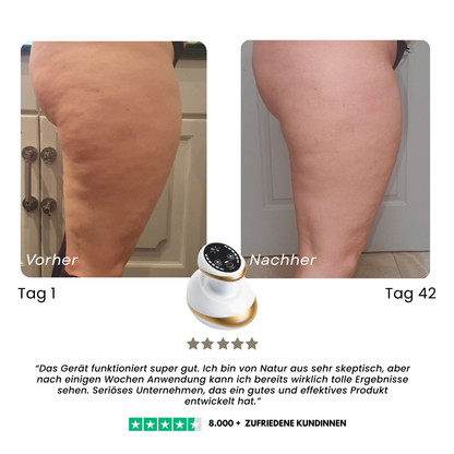 Vinya CelluLisse: Experto en Escultura Corporal desde Casa